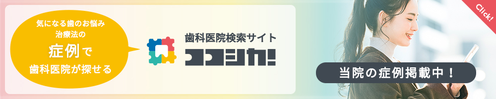 症例で歯科医院が探せる歯科医院検索サイト「ココシカ！」に当院の症例掲載中！