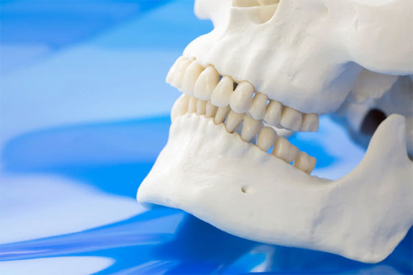 歯と顎の大きさがあっていない骨格イメージ